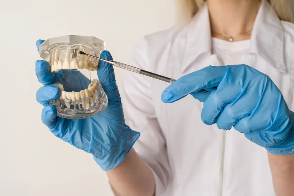 Quanto costa un impianto dentale? Guida ai fattori essenziali 1 quanto costa un impianto dentale
